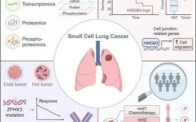 我学者首次大规模揭示小细胞肺癌蛋白组学图谱