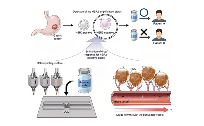 3D生物打印助力胃癌个性化治疗