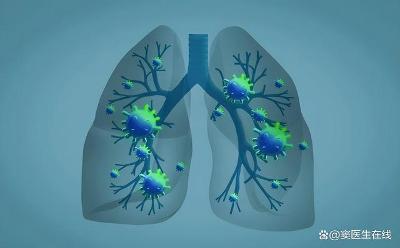 聚焦腫瘤新進展，探索肺癌治療新篇章